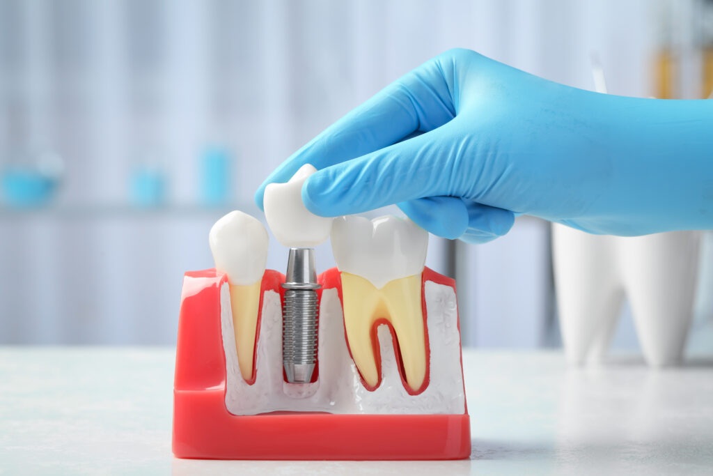 Current image: Best Dental Hospital in Rajahmundry for Root Canal Treatment